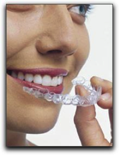 Invisalign Downers Grove