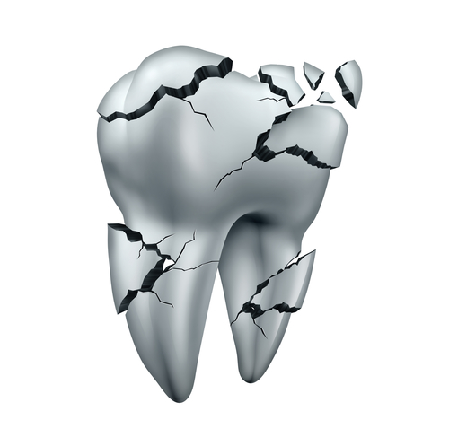 graphic of a tooth crumbling apart due to physical damage